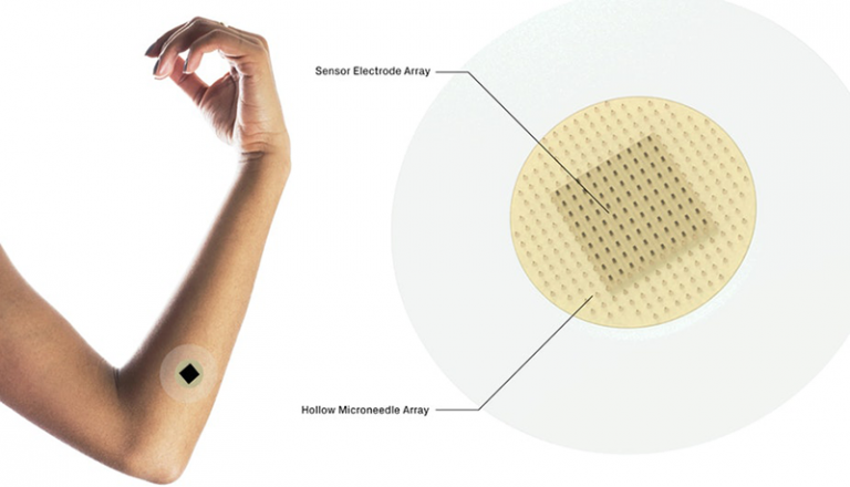 Microneedle systems