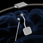 Innovative Brain Implant Reads and Stimulates Brain to Improve Parkinson’s Treatment Parkinsons WAND implant