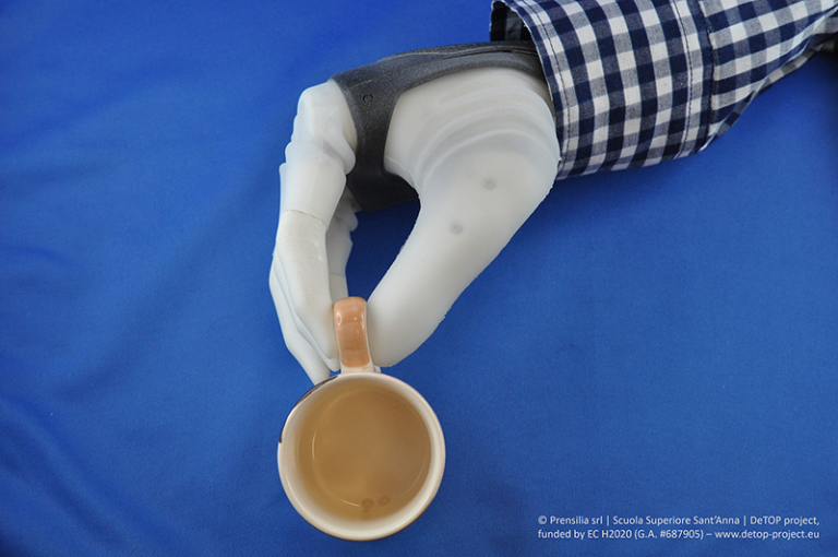 Dexterous, Sentient Prosthetic Hand