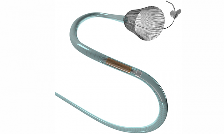 Flex embolization device gets fda approval