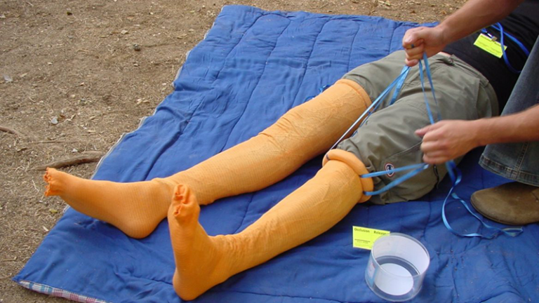 HemaShock Tourniquet