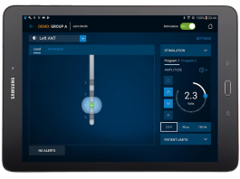 Medtronic to Launch Deep Brain Simulation for Medically-Refractory Epilepsy in the U.S. Medtronic DBS for epilepsy