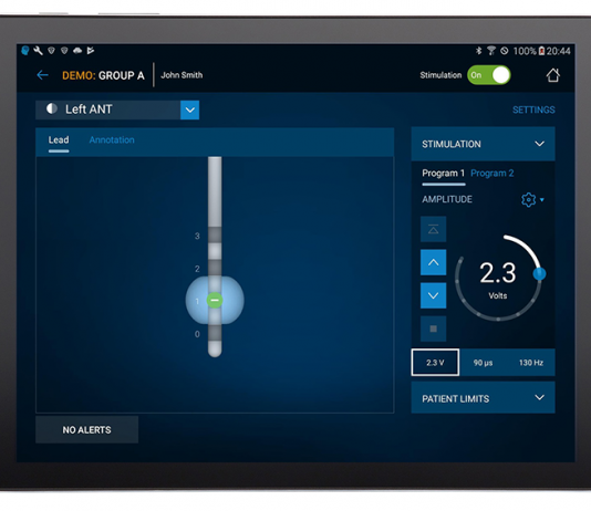 Medtronic to Launch Deep Brain Simulation for Medically-Refractory Epilepsy in the U.S. Medtronic DBS for epilepsy