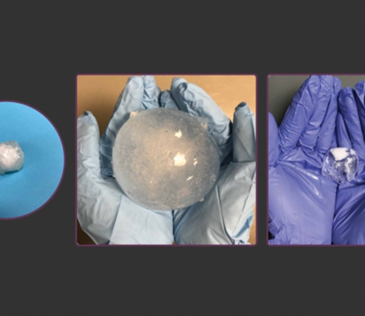 This Smart Pill Stays Inside Your Stomach and Monitors Digestion Up to a Month Smart pill monitors stomach