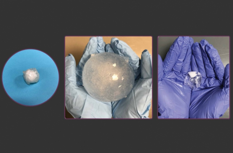 Smart pill monitors stomach