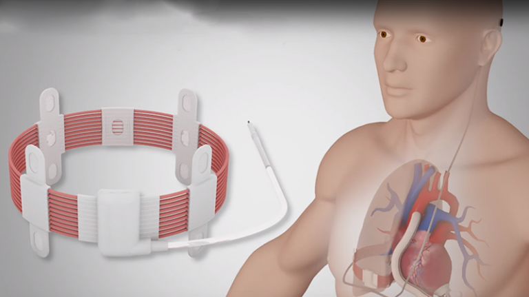 Wirelessly Powered Heart Pump