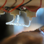 Scientists Engineer Handheld Bioprinter that Can Print Skin to Heal Deep Wounds with Patient’s Own Cells Bioprinter to Heal Deep Wound