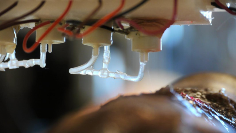 Bioprinter to Heal Deep Wound