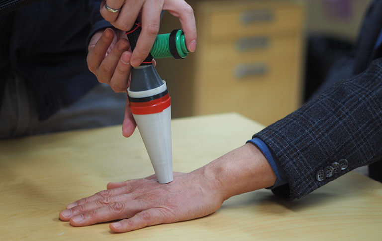 Handheld melanoma detector