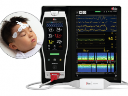 Masimo Receives CE Marking for Next Gen SedLine Brain Function Monitoring for Pediatric Patients SedLine for pediatric patients