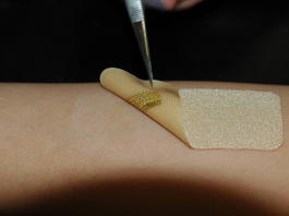 Wearable Biosensors Help Wound Healing Process by Mimicking Skin Wearable biosensor for healing