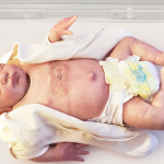 Wireless, Soft, Flexible Sensors Show Promise in Monitoring Premature Babies Wireless sensors for premature babies