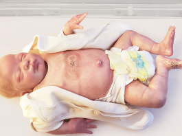 Wireless, Soft, Flexible Sensors Show Promise in Monitoring Premature Babies Wireless sensors for premature babies