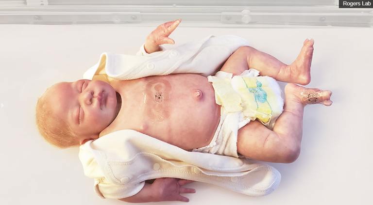 Wireless sensors for premature babies