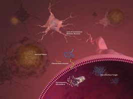 Artificial Intelligence Tool to Boost Alzheimer’s Disease Research AI tool for Alzheimers research