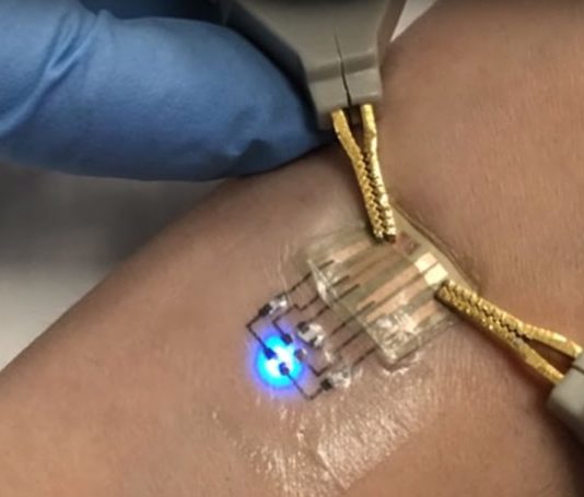 FPC Market will Reach $16.6 billion in 2025 with a Growing Demand from Wearables fpc market growth