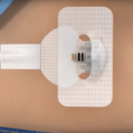 Diagnostic Wearable Medical Devices Market Anticipated to Grow Substantially Through 2025 Diagnostic Wearable Medical Devices