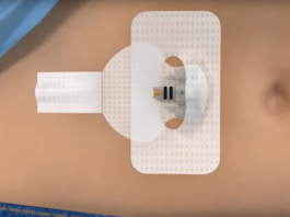 Diagnostic Wearable Medical Devices Market Anticipated to Grow Substantially Through 2025 Diagnostic Wearable Medical Devices