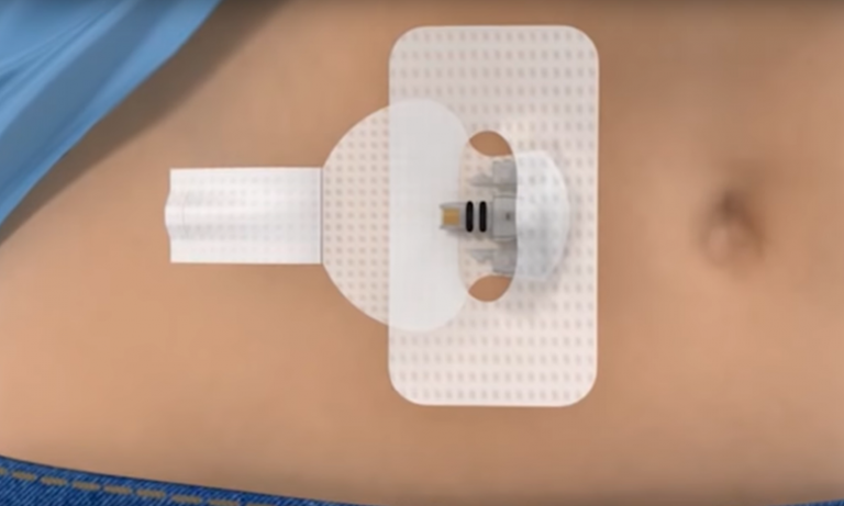 Diagnostic Wearable Medical Devices