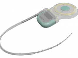 FDA Approves First Cochlear Implants for Single-Sided Deafness and Asymmetric Hearing Loss SYNCHRONY cochlear implants