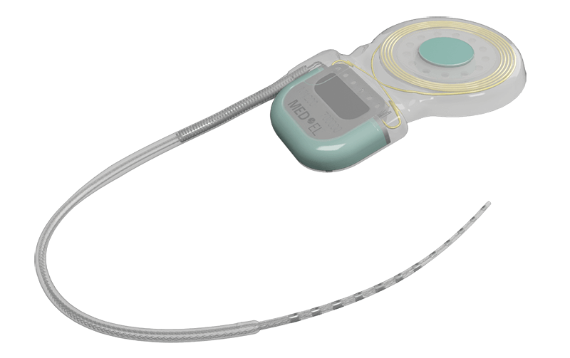SYNCHRONY cochlear implants