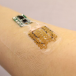 How Smart Bandages Are Transforming Medicine and Healthcare Smart bandages changing medicine