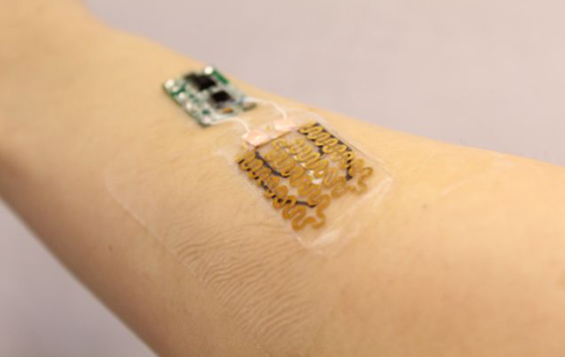 Smart bandages changing medicine