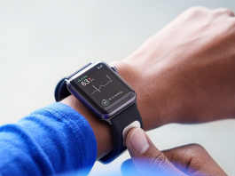 AliveCor Stops Selling KardiaBand, Its ECG Accessory for Apple Watches AliveCor KardiaBand