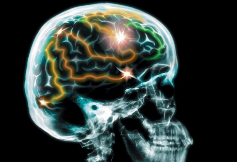 Neuro biomarkers for brain stimulators