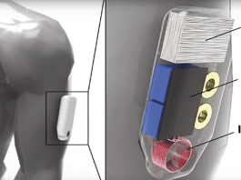 Wearable Sensor Administers Narcan to Prevent Opioid Overdose Deaths Wearable sensor opioid deaths