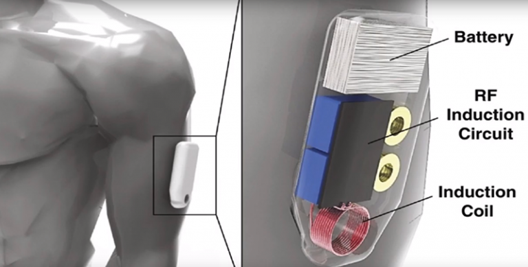 Wearable sensor opioid deaths