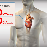 Orchestra BioMed’s BackBeat Cardiac Neuromodulation Therapy Gets CE Mark for Hypertension Treatment BackBeat CNT CE mark