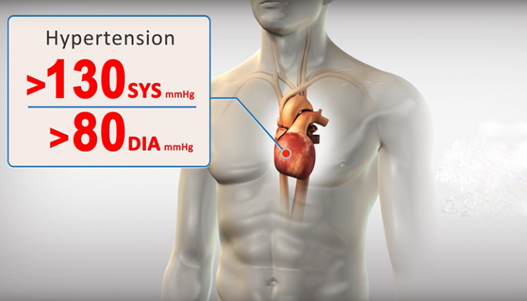 BackBeat CNT CE mark