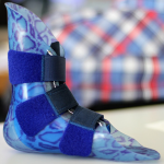 Wearable Gait Analysis Protocol to Help Clinicians Select Ankle-Foot Orthoses Configuration in Cerebral Palsy Patients Wearable Gait Analysis Protocol