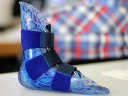 Wearable Gait Analysis Protocol to Help Clinicians Select Ankle-Foot Orthoses Configuration in Cerebral Palsy Patients Wearable Gait Analysis Protocol