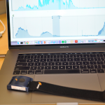 Sweat Sensors to Predict Behavioral Issues in Autistic Children Sweat sensors for autism