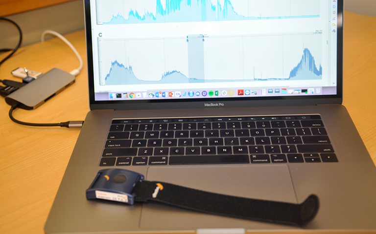 Sweat sensors for autism