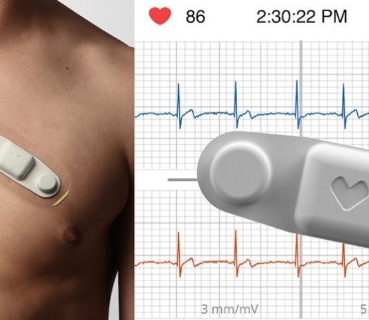 VivaLNK Wins CE Mark for its Wearable ECG Sensor and Accompanying SDK VivaLNK CE mark ECG
