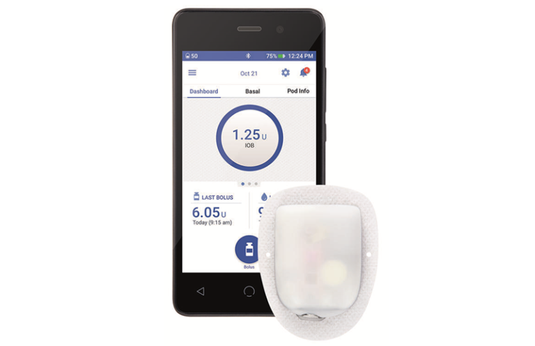Omnipod DASH in Europe