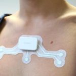 Onera Bioimpedance Patch Uses Artificial Intelligence to Detect Sleep Apnea Onera sleep apnea patch