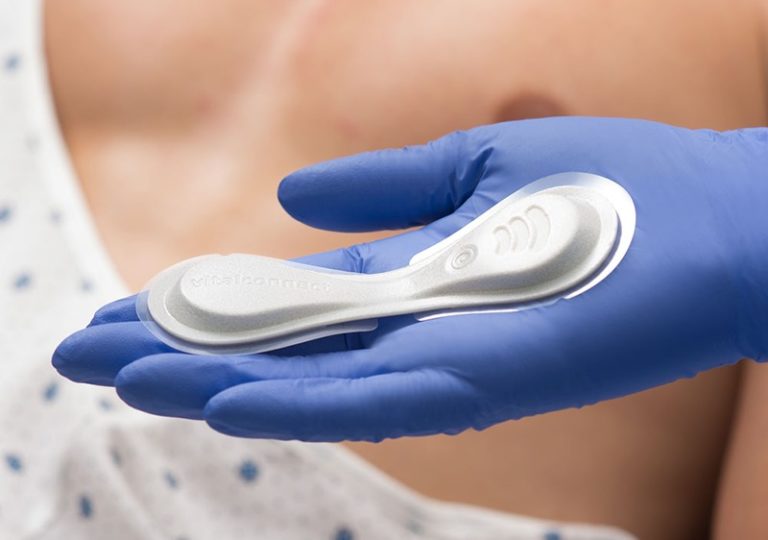 VitalConnect Arrhythmia Detection