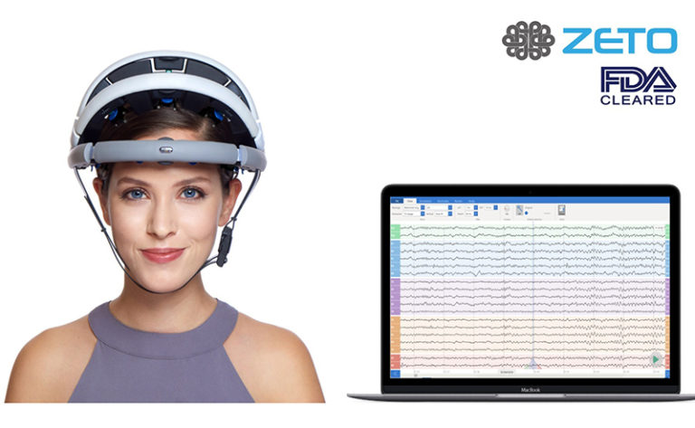 Zeto zEEG headset