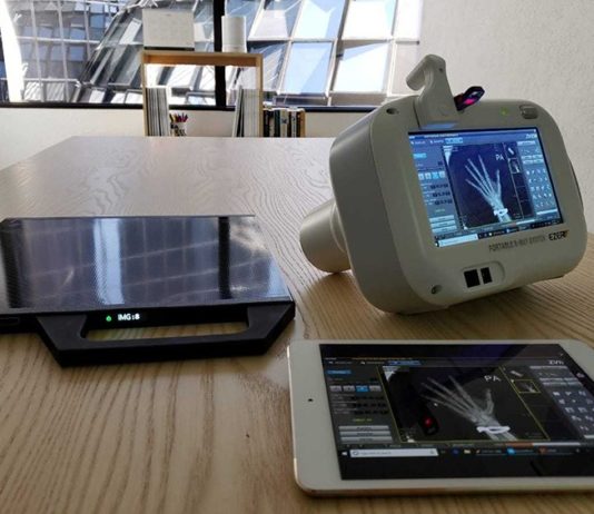 FDA Approves AiRTouch Portable X-Ray, Could Be Potentially Used For COVID-19 Diagnosis AiRTouch Portable X-Ray
