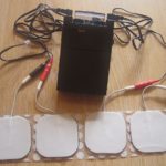 Wearables In Combination With Digital Technology Offers Huge Opportunities For Non-Invasive Pain Management Wearables For Pain Management