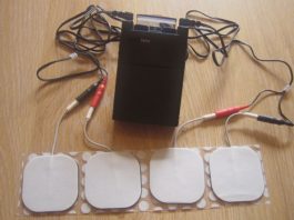 Wearables In Combination With Digital Technology Offers Huge Opportunities For Non-Invasive Pain Management Wearables For Pain Management