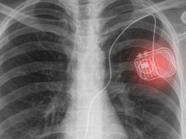 South Korean Researchers Develop Method To Wirelessly Power Medical Implants Using Light Light photon to Power medical implants