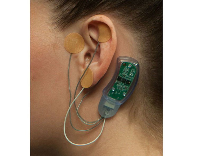 Masimo bridge opioid withdrawal symptoms