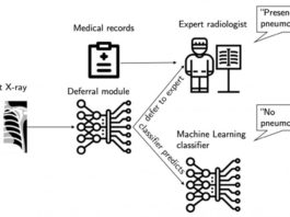 AI System From MIT CSAIL Diagnoses Pneumonia And Knows When To Defer To A Radiologist MIT AI system diagnoses pneumonia