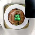 Australian Researchers Develop Brain Implant That May Restore Limited Sight In Blind People Monash University brain implant for blind people