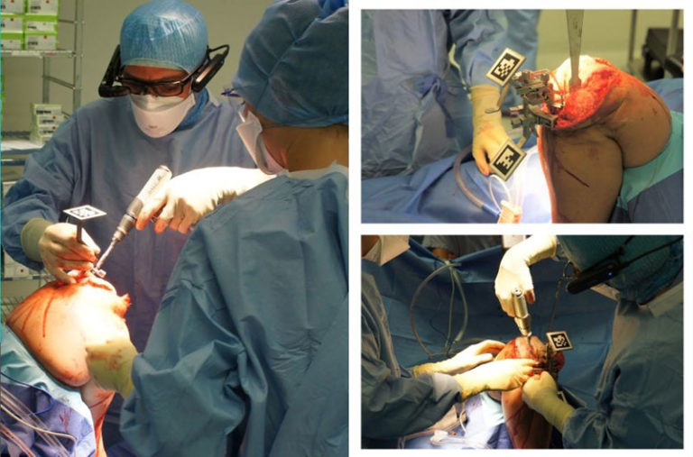 Pixee medical Vuzix M400 Knee Surgery